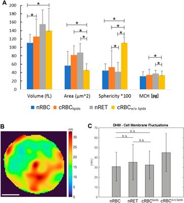 Biomechanical properties of native and cultured red blood cells–Interplay of shape, structure and biomechanics